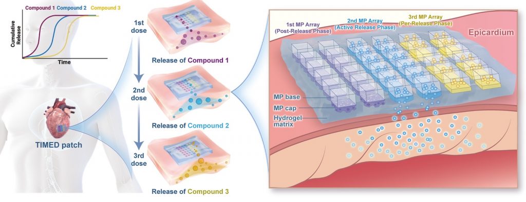 بسته هیدروژلی دارو برای درمان قلب پس از سکته
