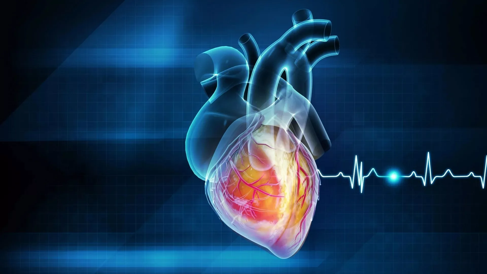 پژوهش جدید:‌ حمله قلبی ممکن است مسری و عفونی باشد