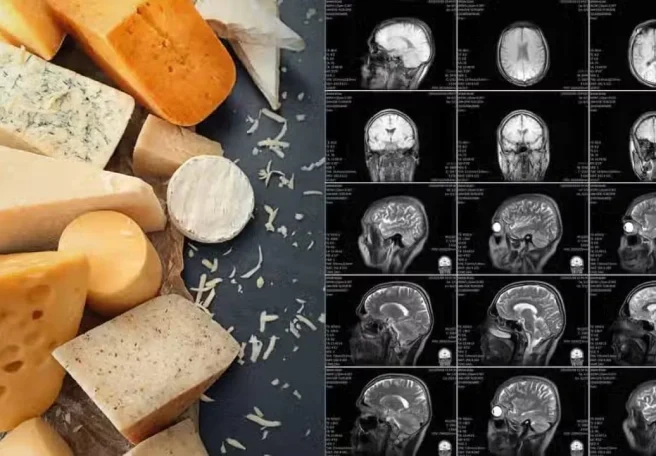 مصرف هفتگی پنیر می‌تواند خطر زوال عقل را کاهش دهد