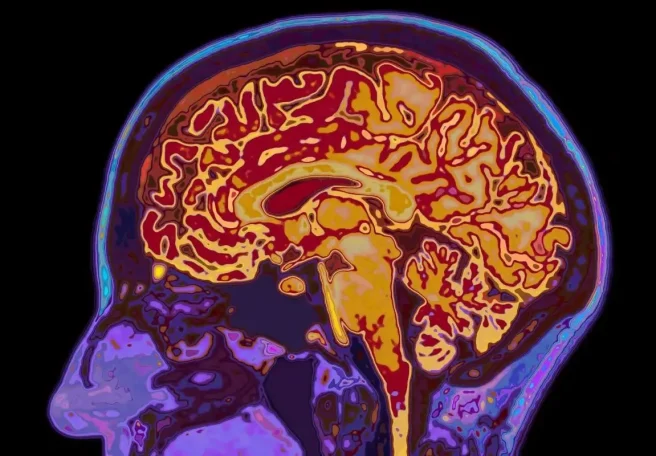 کشف ۵ دوره رشد مغز توسط دانشمندان؛ مغز انسان تا ۳۲ سالگی بالغ نمی‌شود