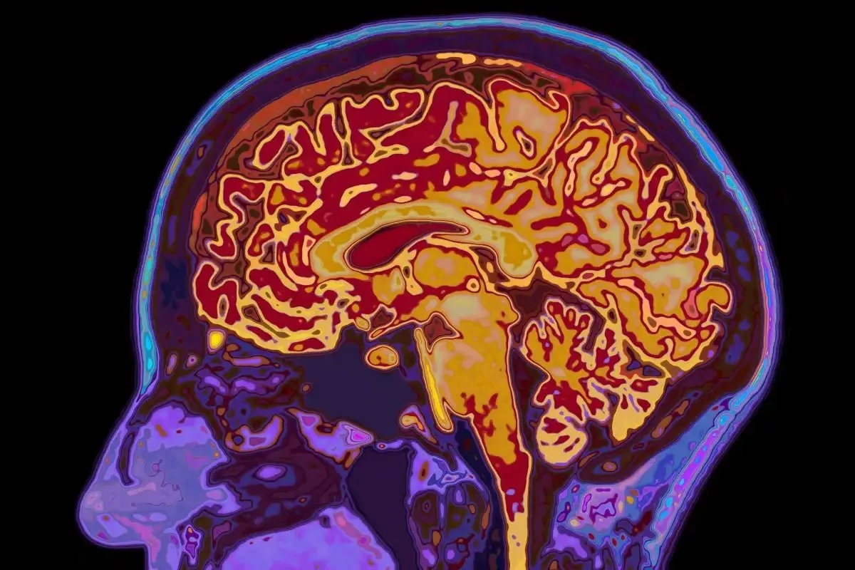 کشف ۵ دوره رشد مغز توسط دانشمندان؛ مغز انسان تا ۳۲ سالگی بالغ نمی‌شود