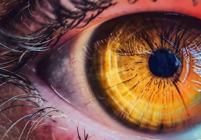 تغییر ساعت تابستانی خطر ابتلا به بیماری‌های چشمی را تا ۳۰ درصد افزایش می‌دهد